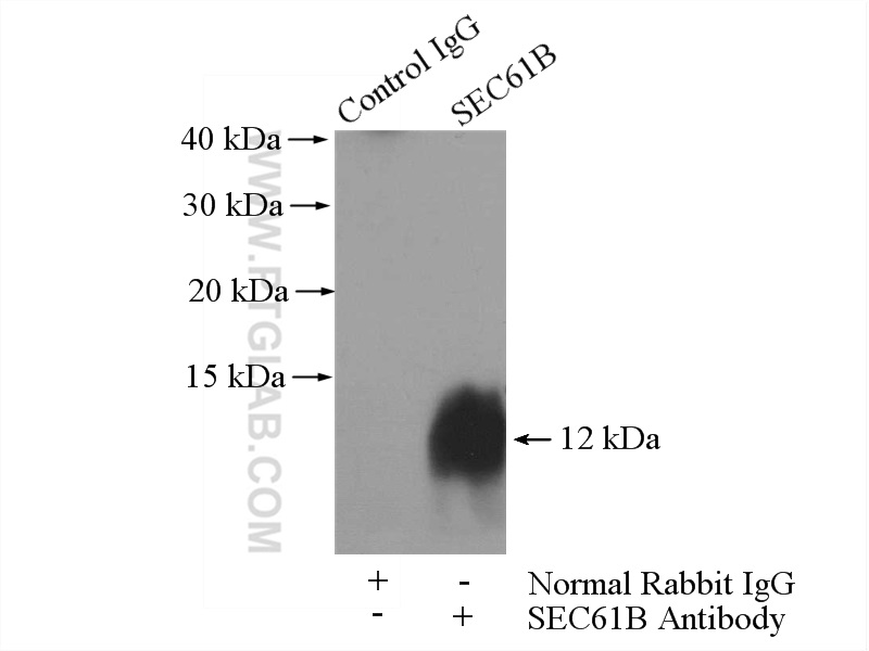 IP experiment of HepG2 using 15087-1-AP