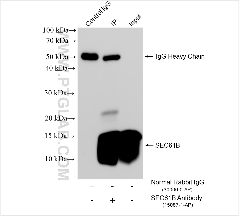 IP result of anti-SEC61B (IP:15087-1-AP, 4ug; Detection:15087-1-AP 1:4000) with HepG2 cells lysate 1480 ug. IP experiment of HepG2 using 15087-1-AP
