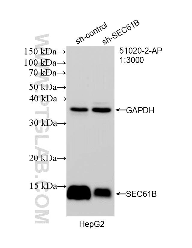 WB analysis of HepG2 using 51020-2-AP WB analysis of HepG2 using 51020-2-AP