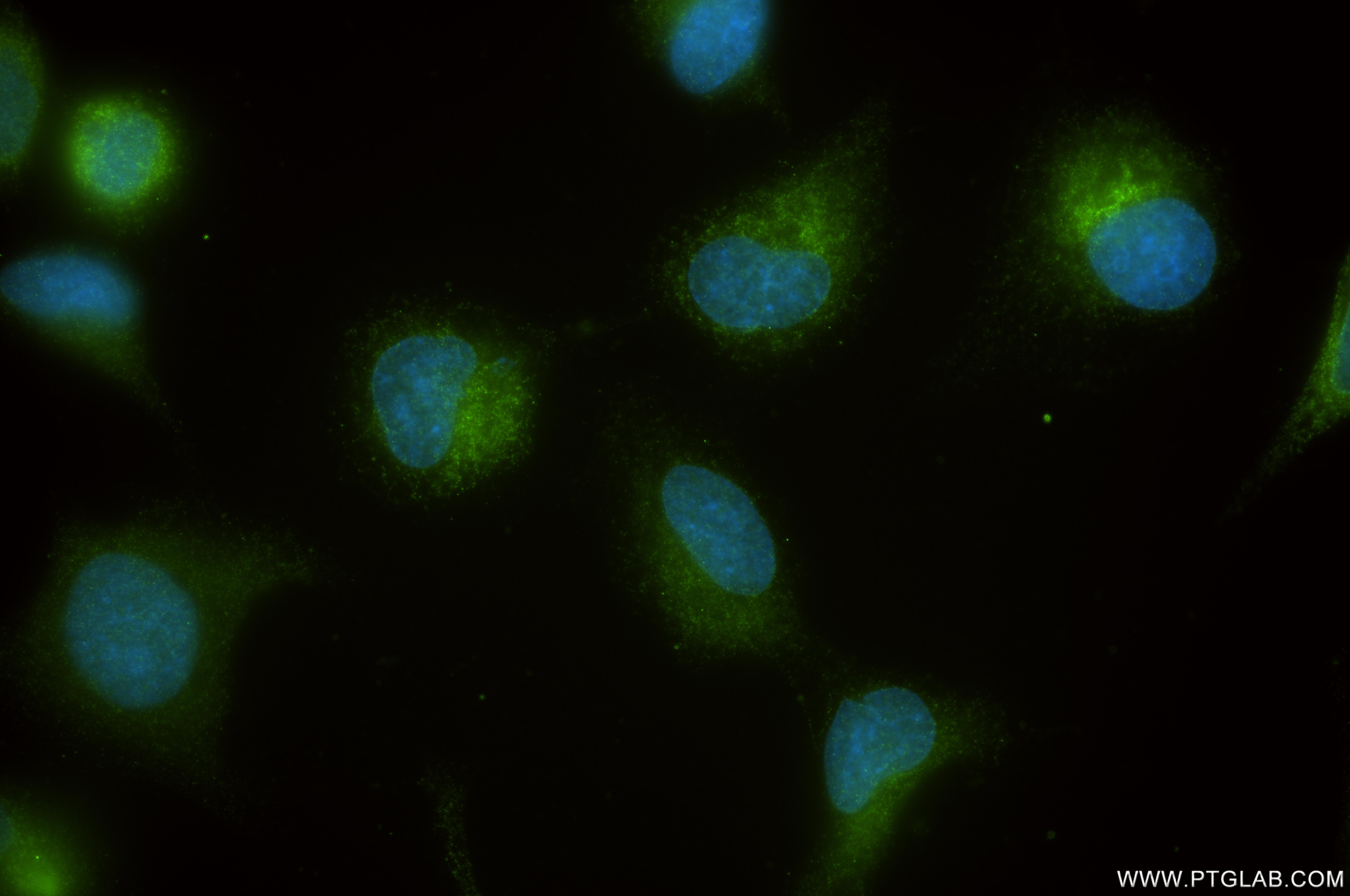 IF Staining of HeLa using 85805-2-RR IF Staining of HeLa using 85805-2-RR