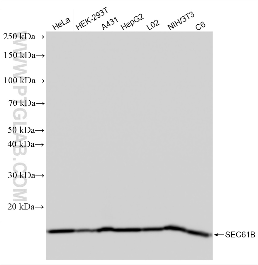 WB analysis using 85805-2-RR WB analysis using 85805-2-RR
