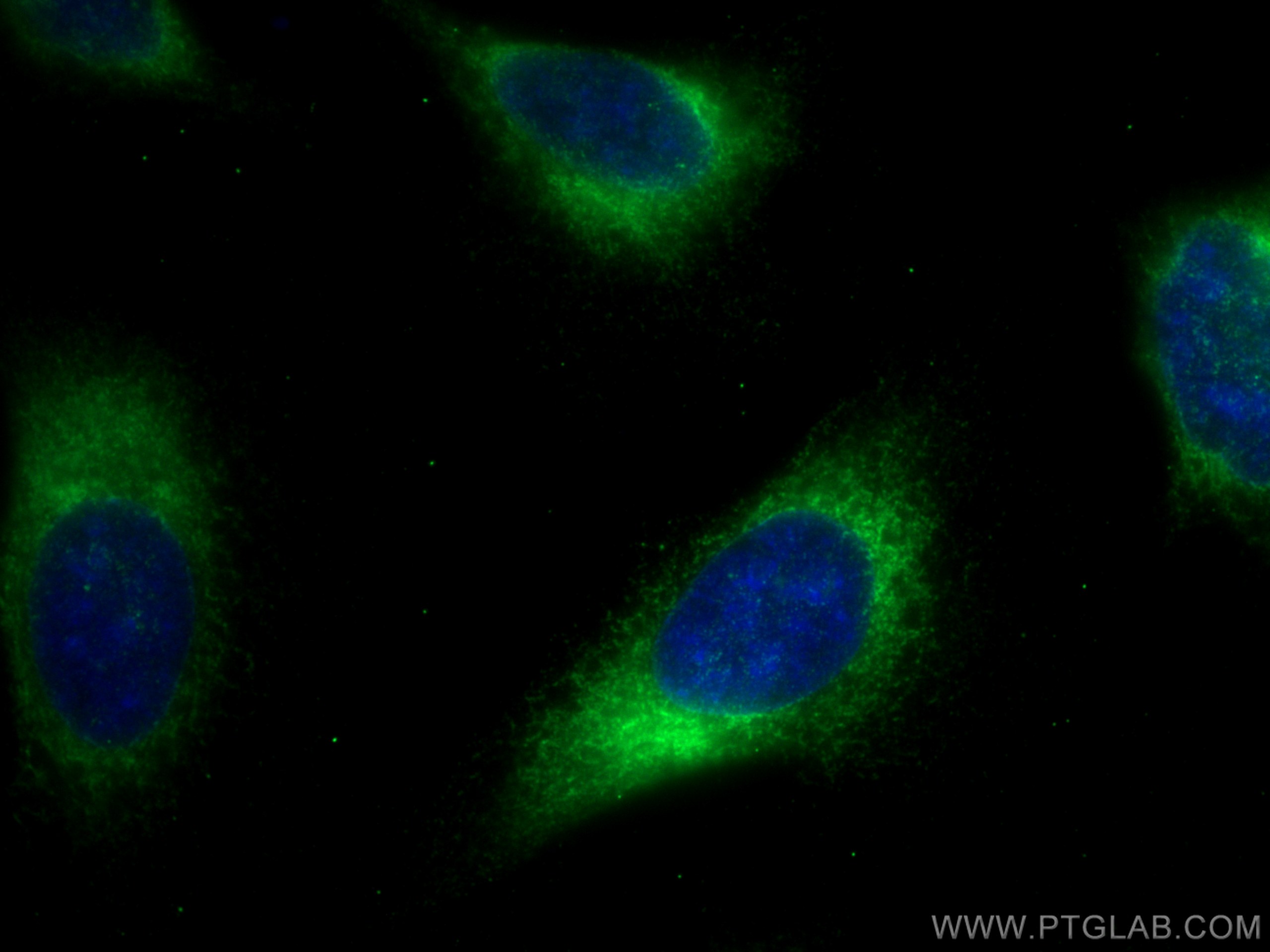 IF Staining of HeLa using 14846-1-AP (same clone as 14846-1-PBS)
