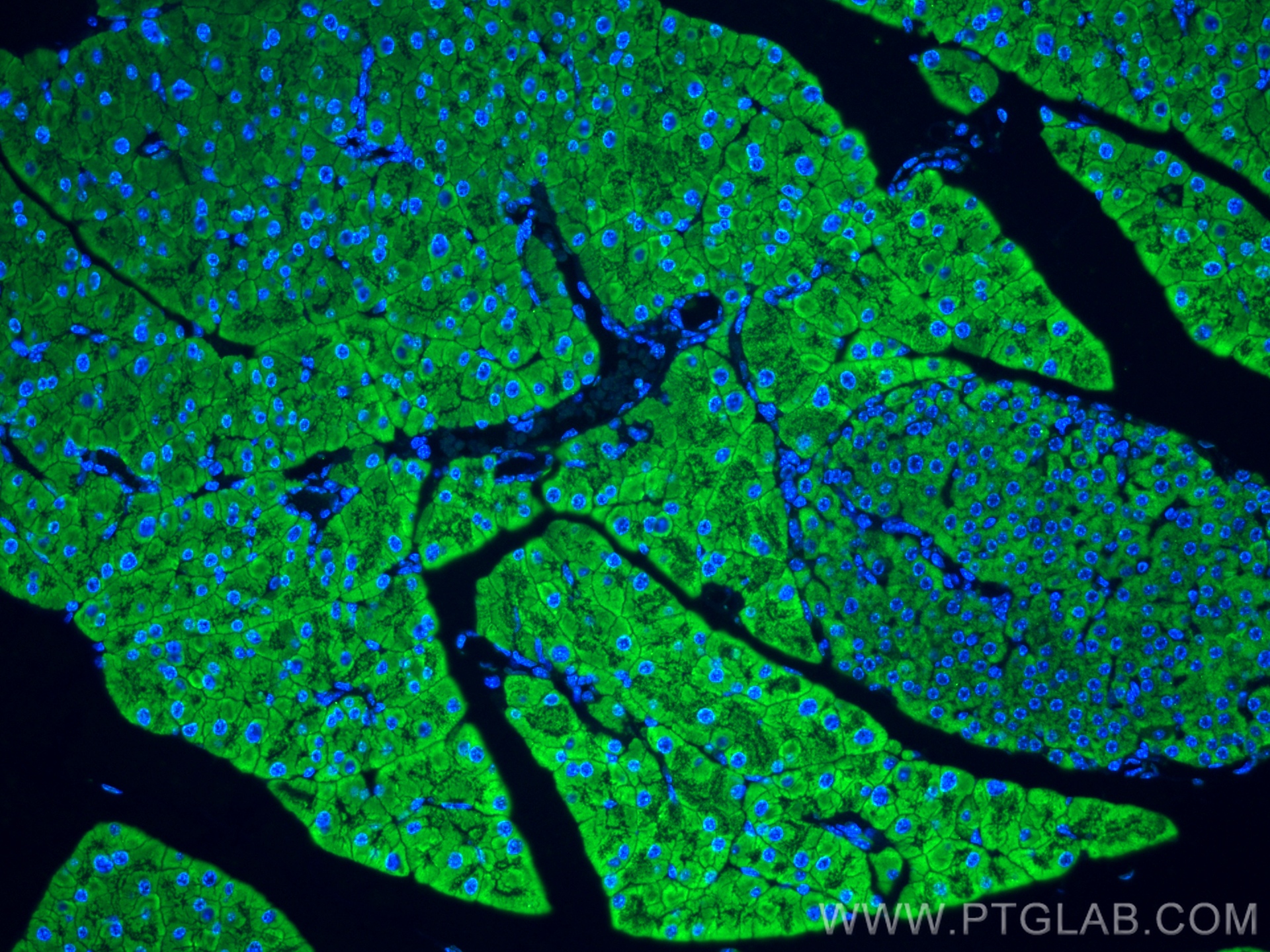IF Staining of mouse pancreas using 14846-1-AP