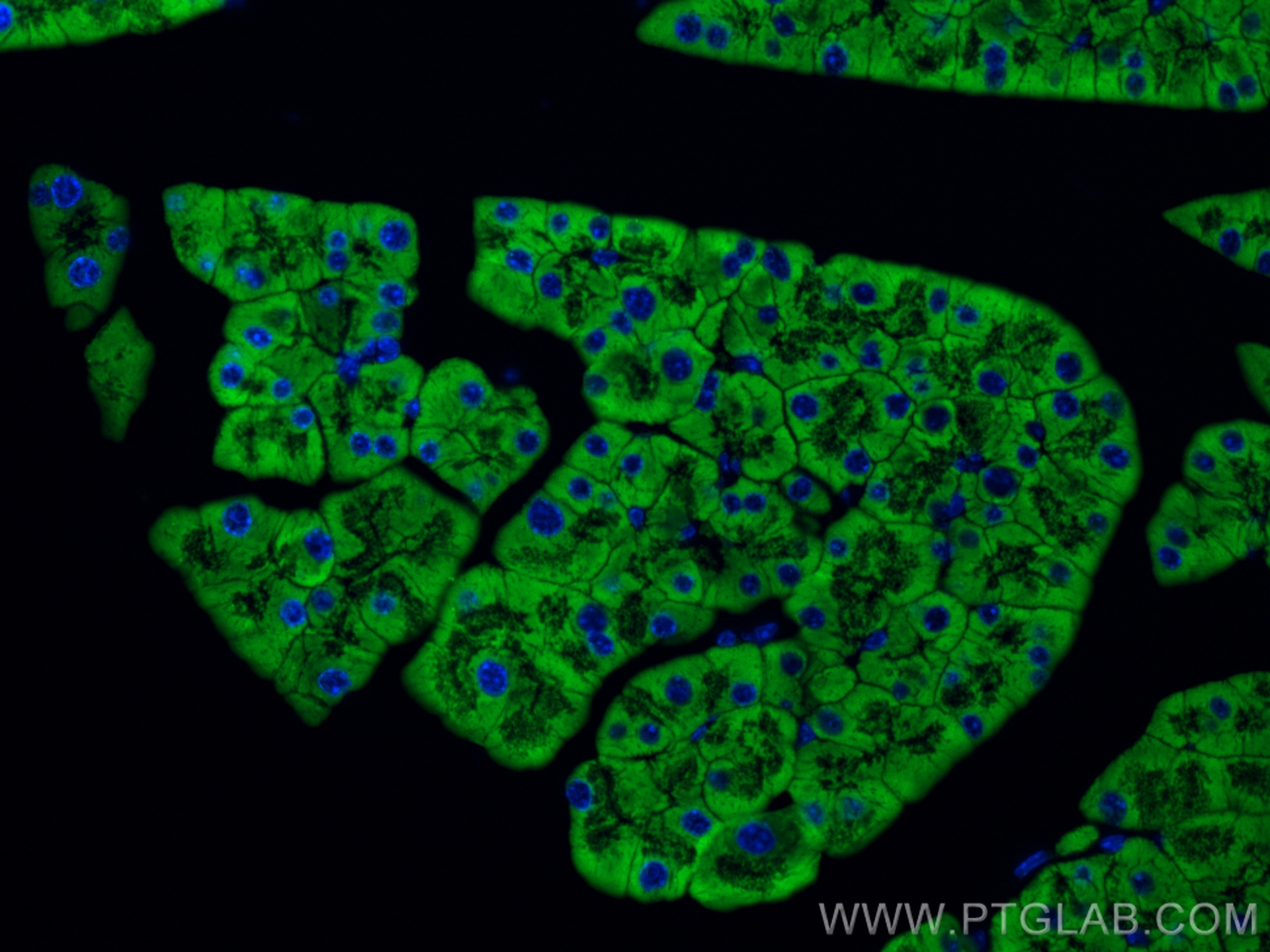 IF Staining of mouse pancreas using 14846-1-AP