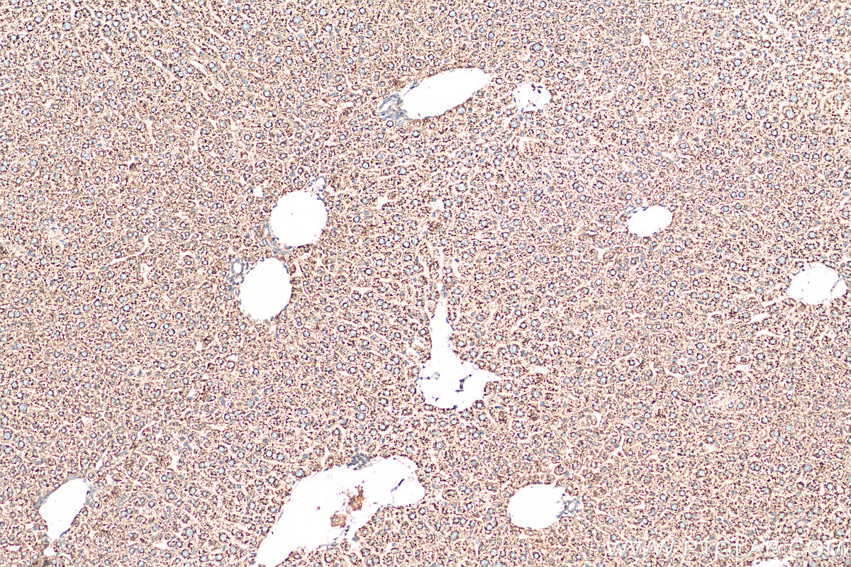 IHC staining of mouse liver using 14846-1-AP