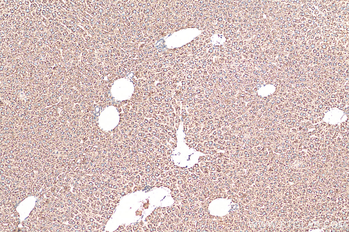 IHC staining of mouse liver using 14846-1-AP (same clone as 14846-1-PBS)