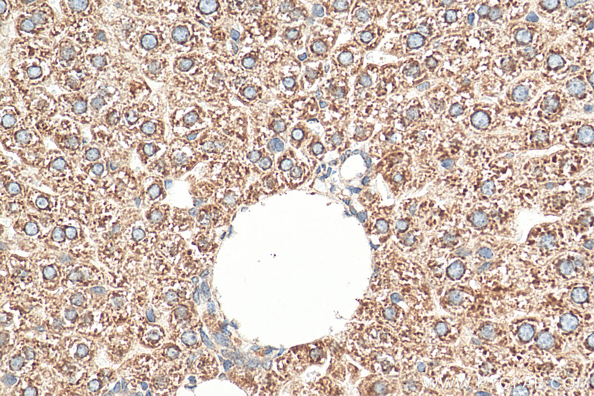 IHC staining of mouse liver using 14846-1-AP