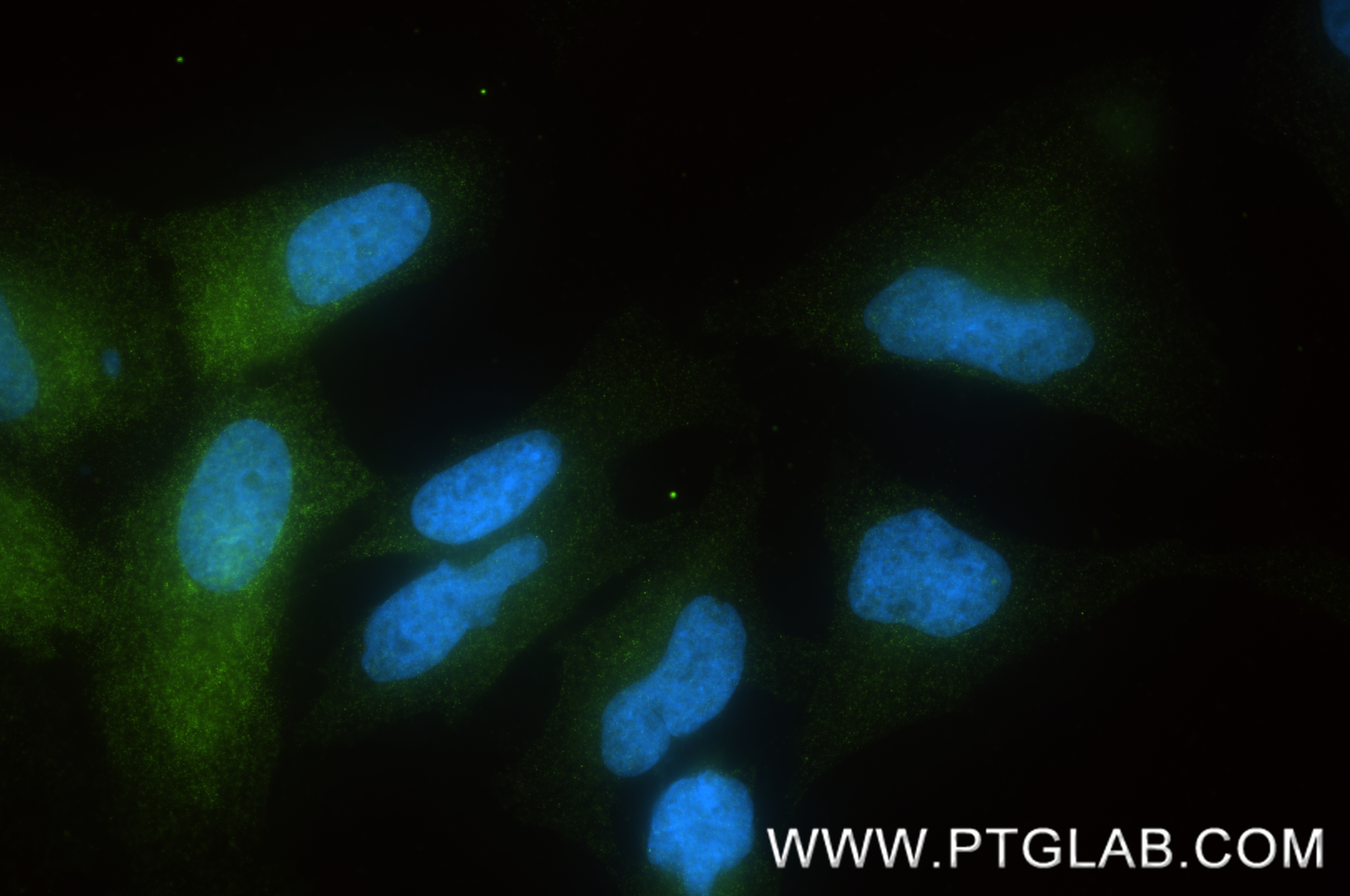 IF Staining of HeLa using 87925-1-RR IF Staining of HeLa using 87925-1-RR