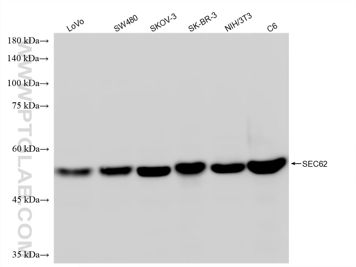 WB analysis using 87925-1-RR WB analysis using 87925-1-RR