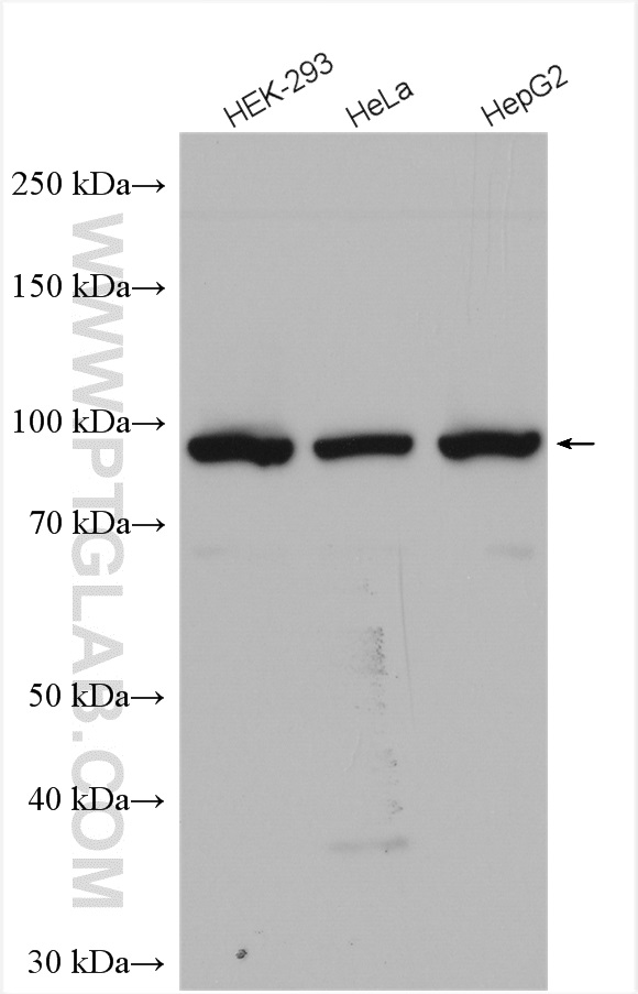 WB analysis using 28665-1-AP