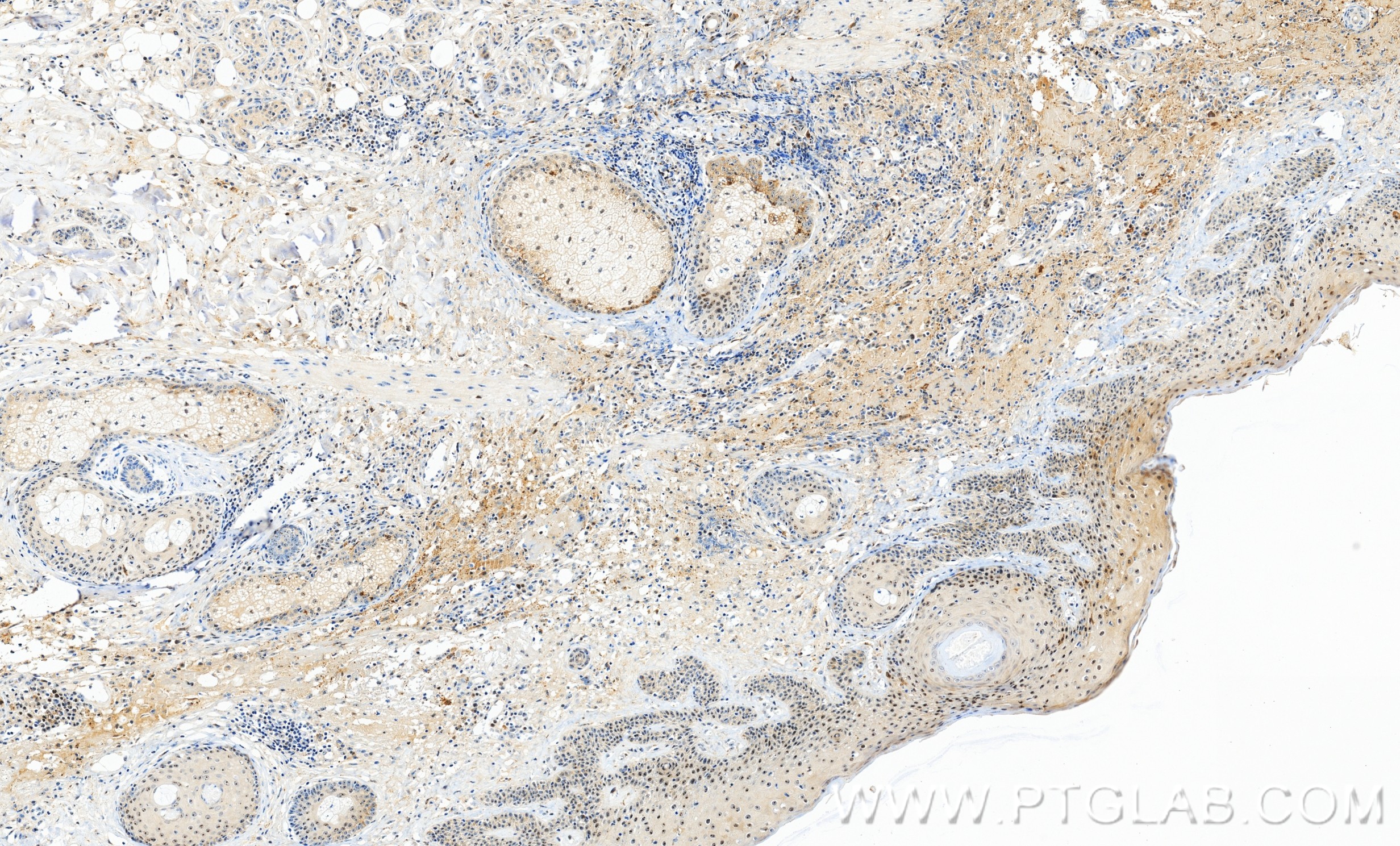 IHC staining of human skin using 86488-1-RR IHC staining of human skin using 86488-1-RR