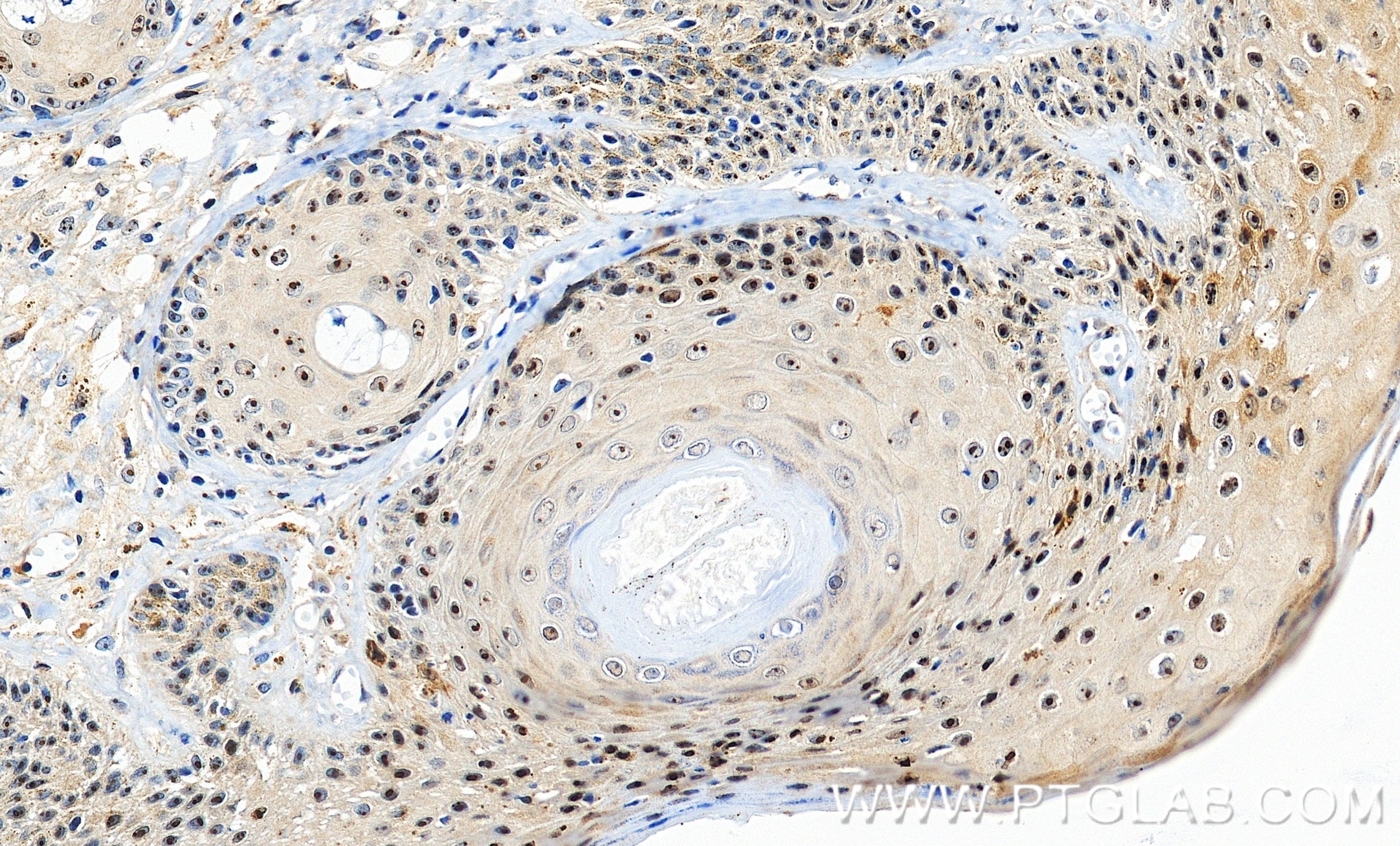 IHC staining of human skin using 86488-1-RR IHC staining of human skin using 86488-1-RR