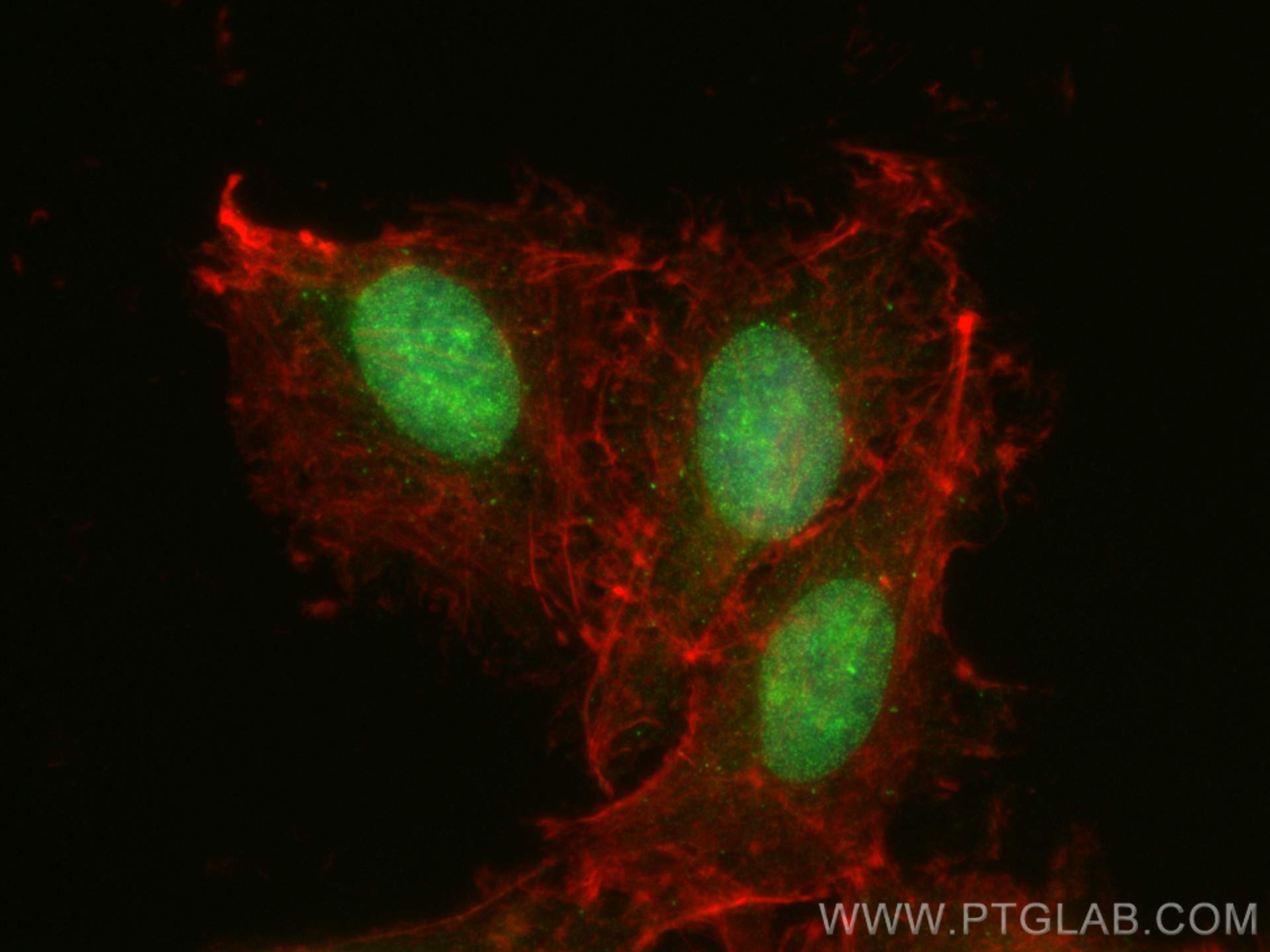 IF Staining of A549 using 15565-1-AP