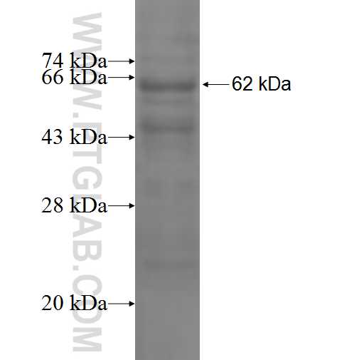 SEH1L fusion protein Ag2941 SDS-PAGE SEH1L fusion protein Ag2941 SDS-PAGE
