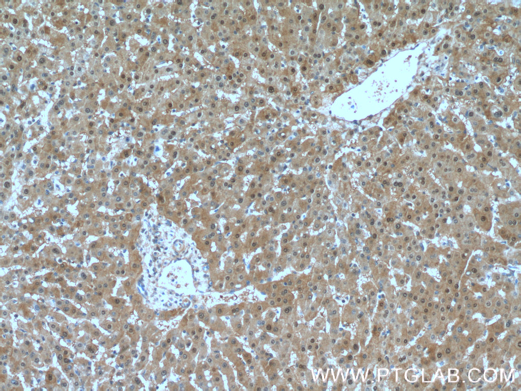 IHC staining of human liver using 27230-1-AP