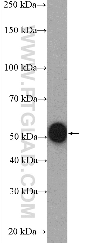 WB analysis of mouse liver using 27230-1-AP