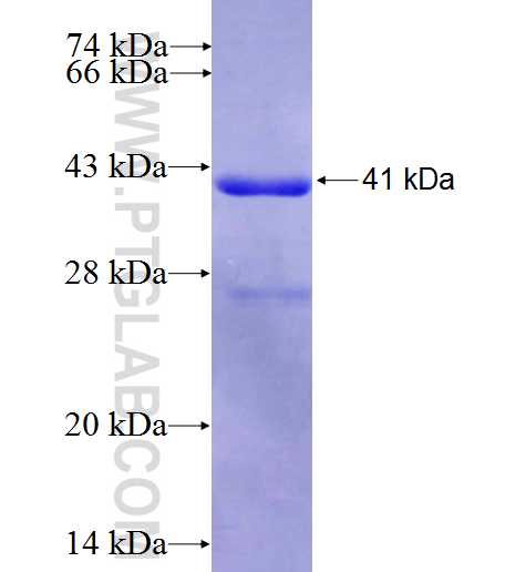 SELENBP1 fusion protein Ag24453 SDS-PAGE