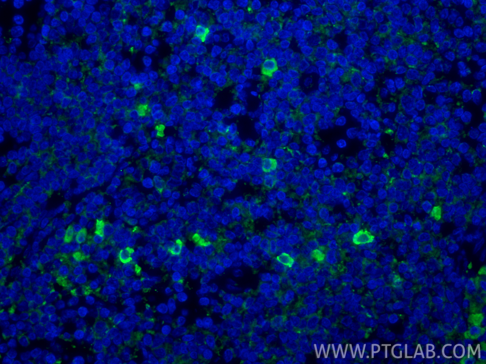 Immunofluorescent analysis of (4% PFA) fixed paraffin-embedded human tonsillitis tissue using CD62L antibody (26477-1-AP) at dilution of 1:200 and CoraLite®488-Conjugated Goat Anti-Rabbit IgG(H+L) (<a class='green' href='/productredirect?CatalogNo=SA00013-2' target='_blank'>SA00013-2</a>). Heat mediated antigen retrieval with Tris-EDTA buffer (pH 9.0). IF Staining of human tonsillitis using 26477-1-AP