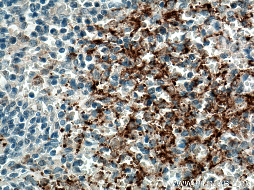 IHC staining of human spleen using 13304-1-AP