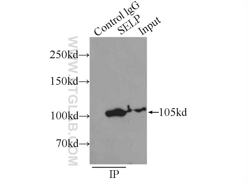 IP experiment of K-562 using 60322-1-Ig