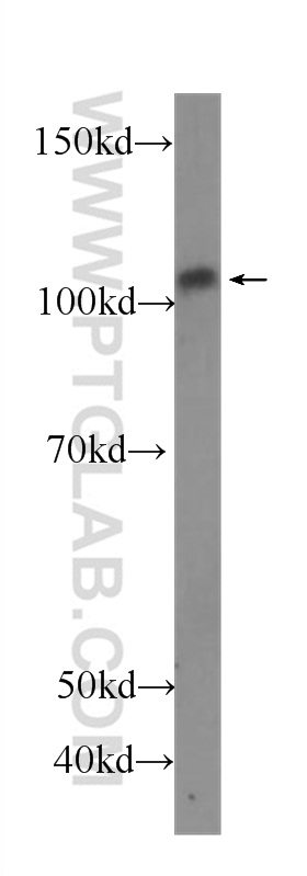 P-selectin / CD62P Monoclonal antibody