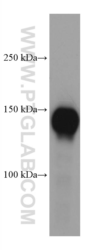 WB analysis of human peripheral blood platelets using 60322-1-Ig (same clone as 60322-1-PBS)