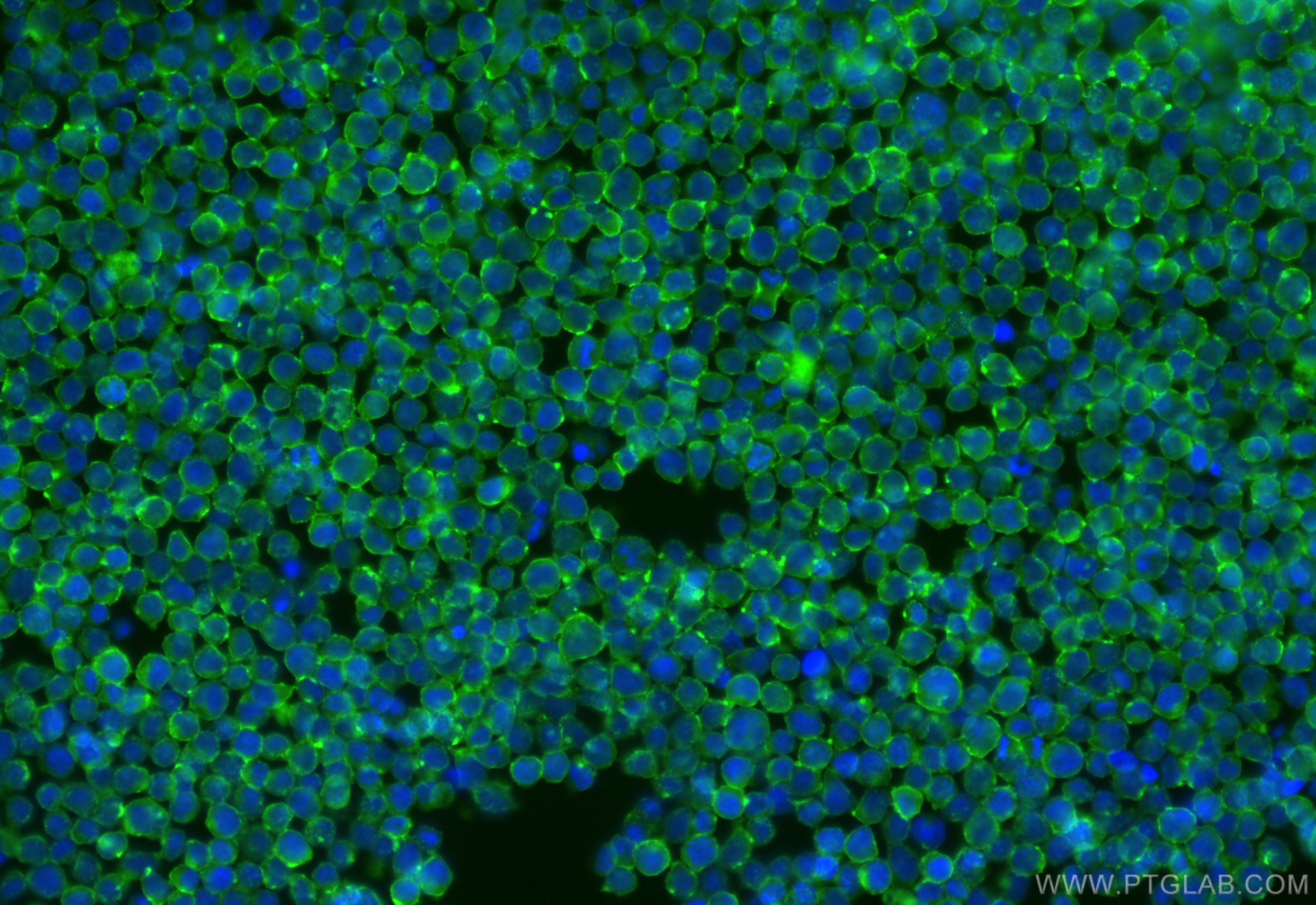 IF Staining of Jurkat using CL488-84500