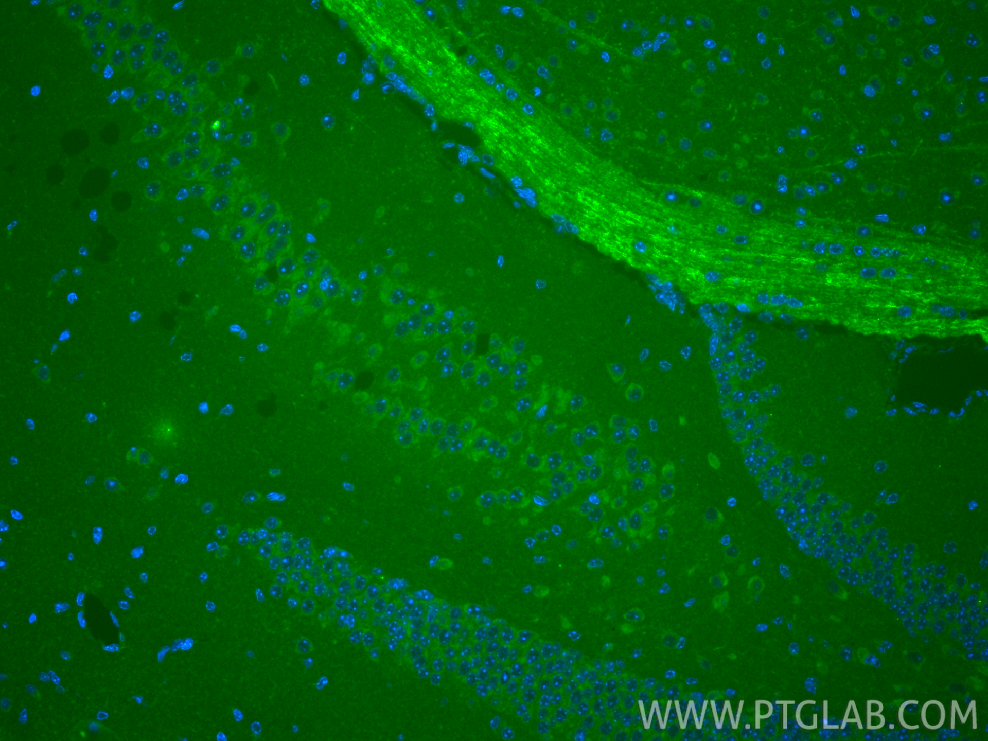 IF Staining of mouse brain using 15591-1-AP
