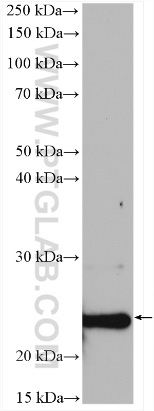 WB analysis of rat brain using 15591-1-AP