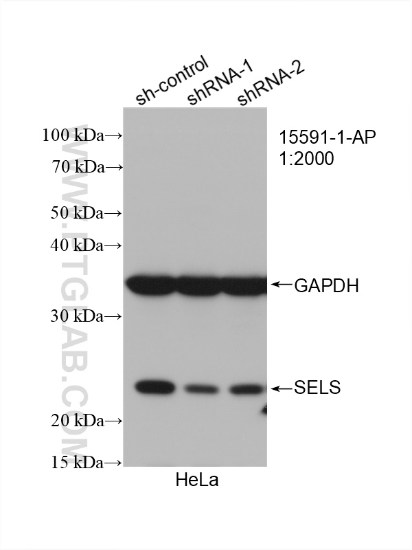 WB analysis of HeLa using 15591-1-AP