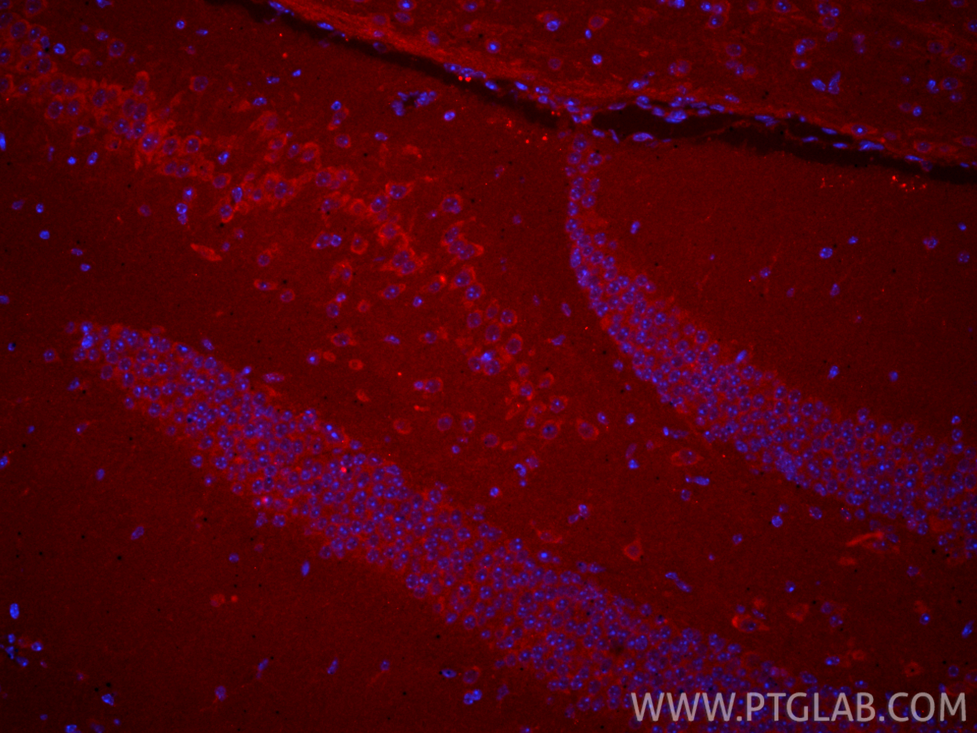 IF Staining of mouse brain using CL594-15591 IF Staining of mouse brain using CL594-15591