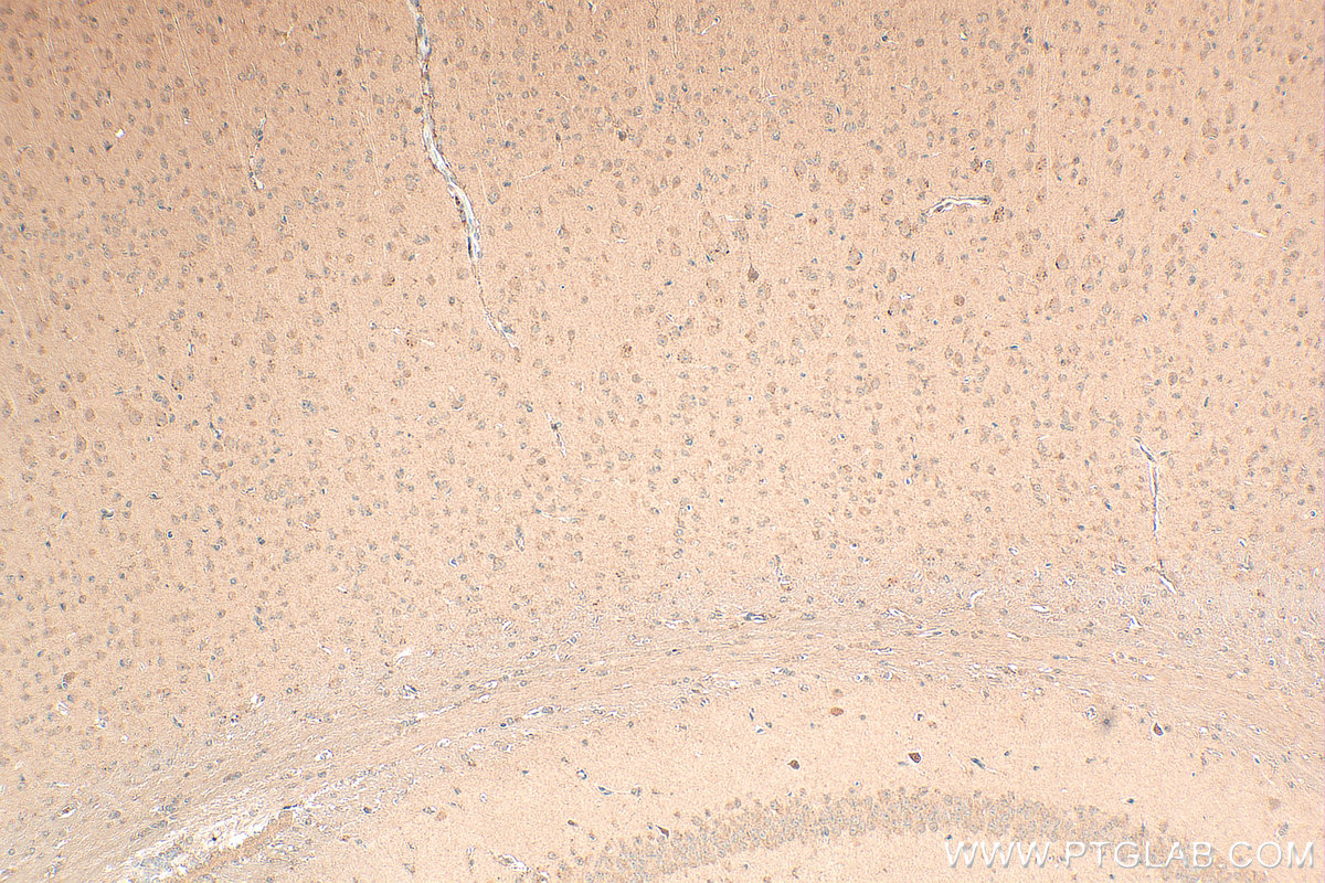 IHC staining of mouse brain using 27836-1-AP IHC staining of mouse brain using 27836-1-AP