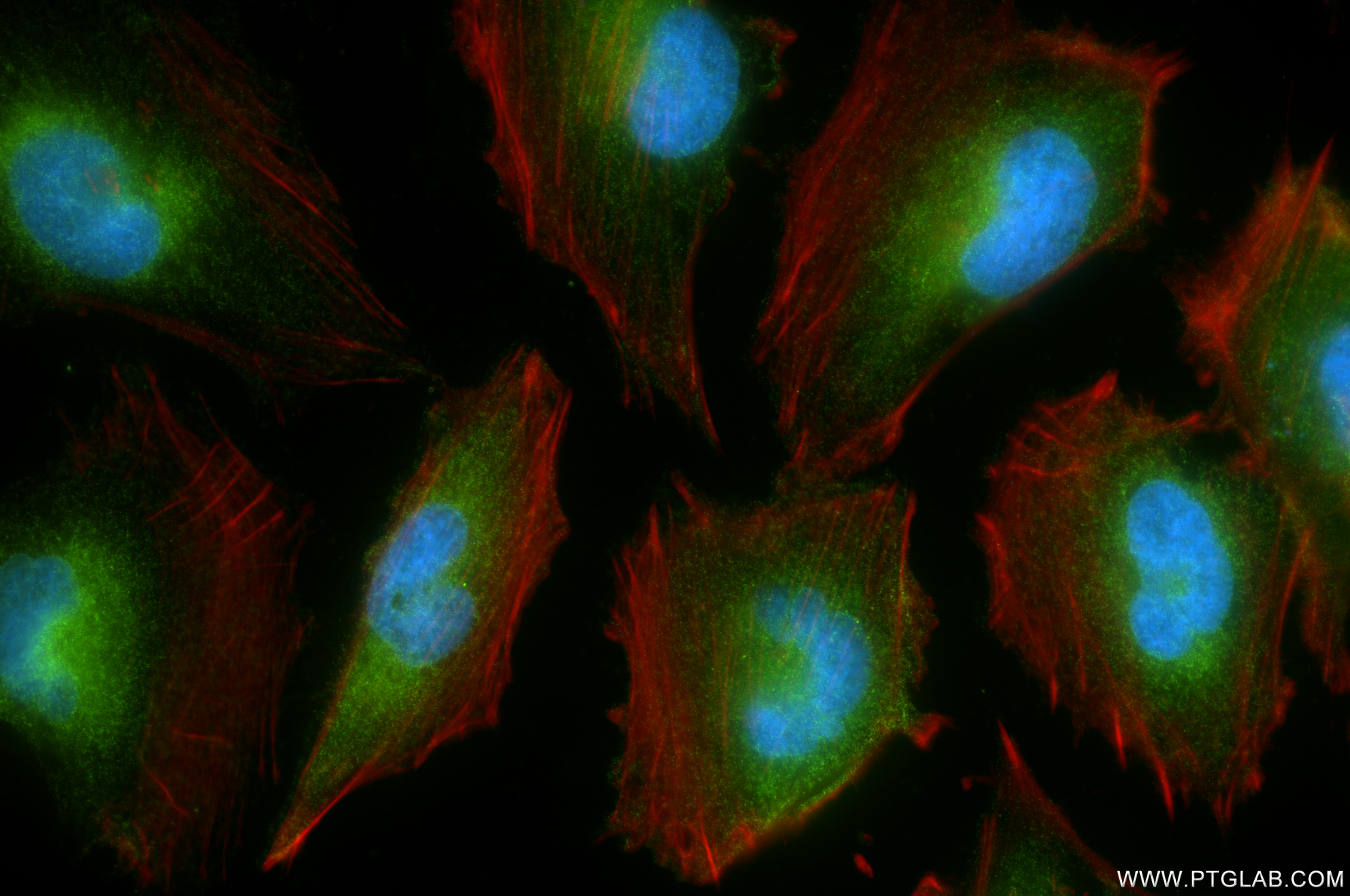 IF Staining of U-251 using 84080-3-RR (same clone as 84080-3-PBS)