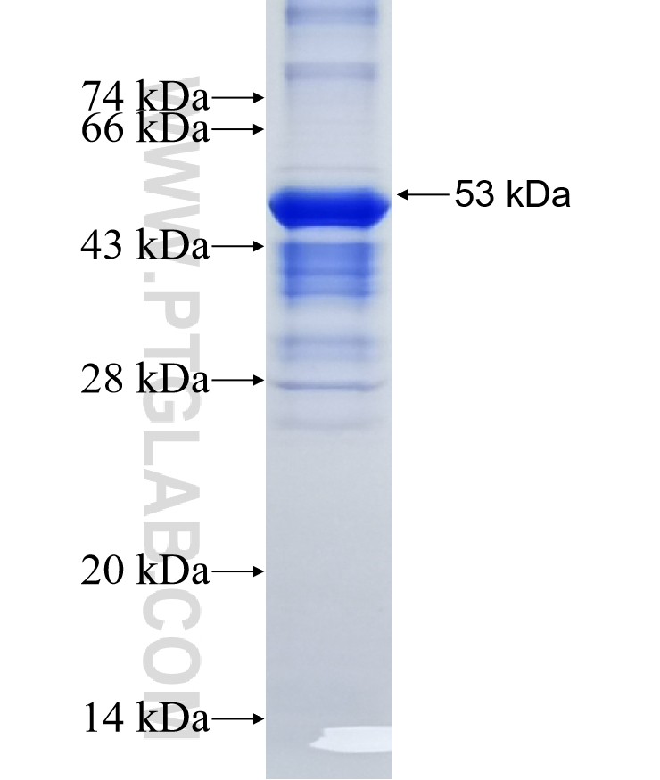 SEMA3E fusion protein Ag16290 SDS-PAGE SEMA3E fusion protein Ag16290 SDS-PAGE