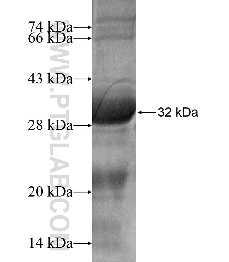 SEMA3E fusion protein Ag17126 SDS-PAGE SEMA3E fusion protein Ag17126 SDS-PAGE