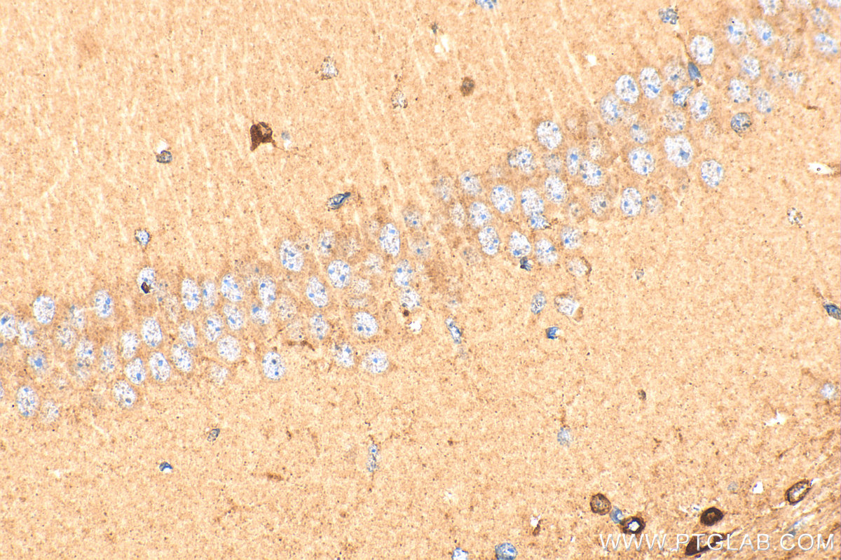 IHC staining of mouse brain using 29191-1-AP