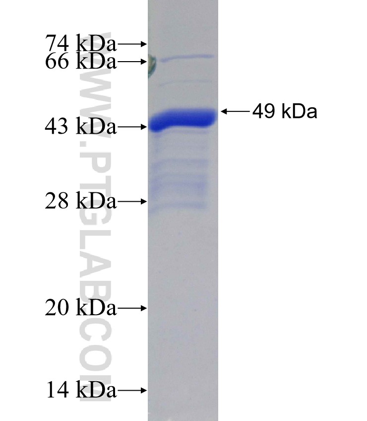 SEMA4B fusion protein Ag30422 SDS-PAGE