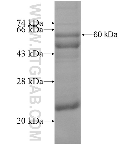 SEMA4B fusion protein Ag10430 SDS-PAGE