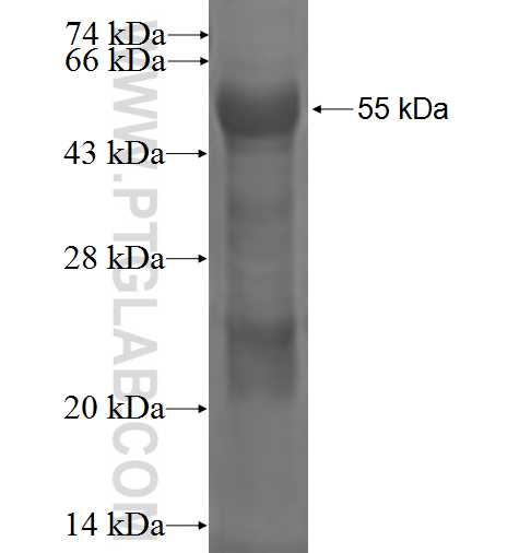 SEMA4B fusion protein Ag1152 SDS-PAGE SEMA4B fusion protein Ag1152 SDS-PAGE