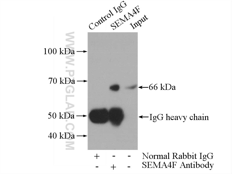 IP experiment of HepG2 using 12474-1-AP