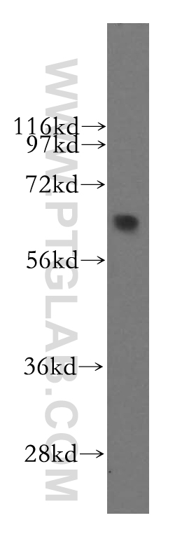 WB analysis of mouse lung using 12474-1-AP