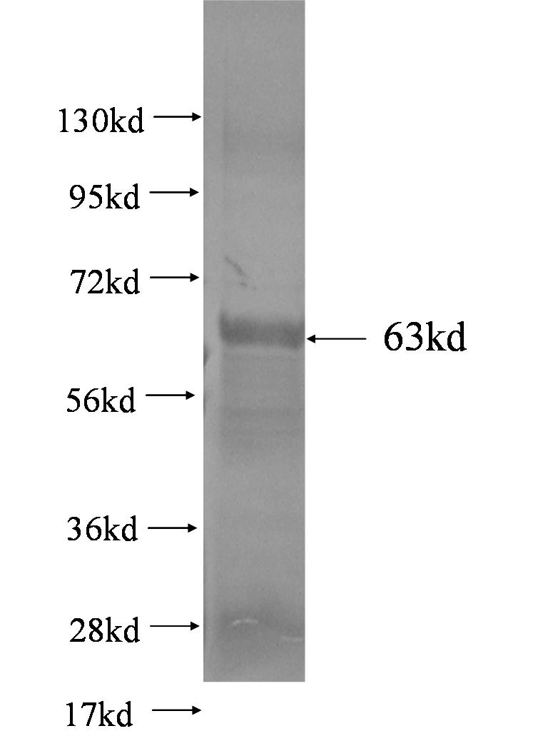 SEMA4F fusion protein Ag3082 SDS-PAGE