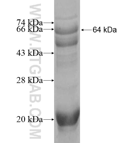 SEMA5B fusion protein Ag10229 SDS-PAGE SEMA5B fusion protein Ag10229 SDS-PAGE