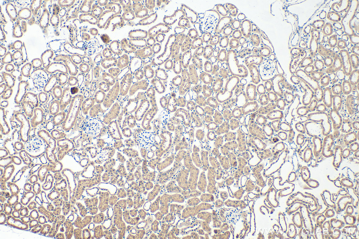 IHC staining of mouse kidney using 15916-1-AP