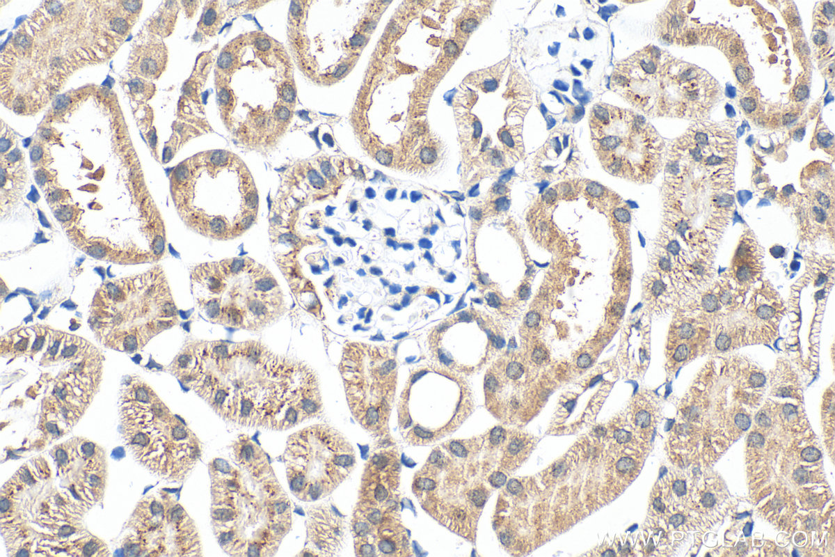 IHC staining of mouse kidney using 15916-1-AP