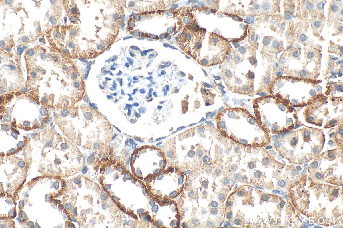 IHC staining of rat kidney using 15916-1-AP