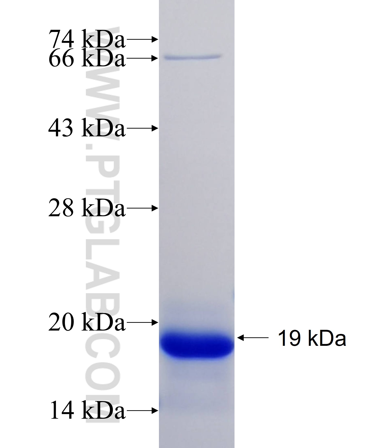 SEMG1 fusion protein Ag33918 SDS-PAGE SEMG1 fusion protein Ag33918 SDS-PAGE
