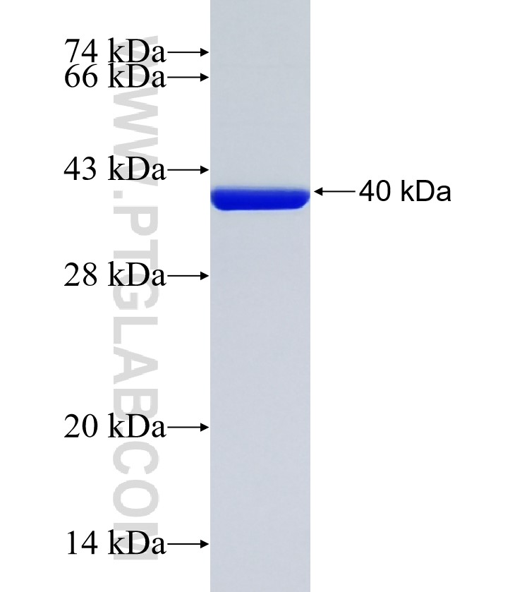 SEMG2 fusion protein Ag35285 SDS-PAGE