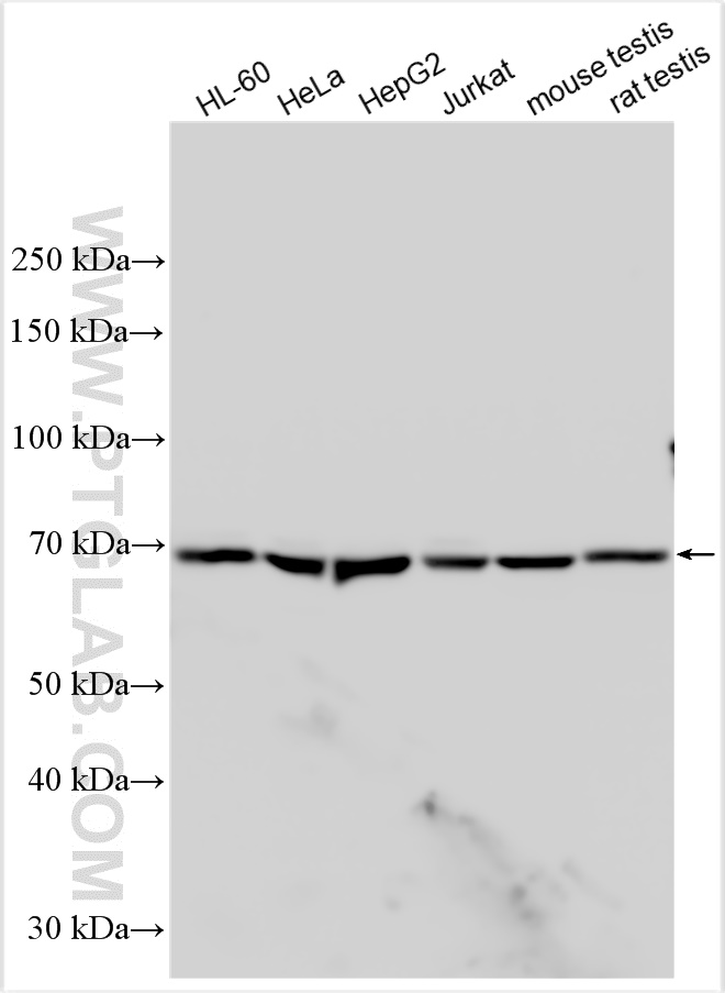 WB analysis using 25349-1-AP