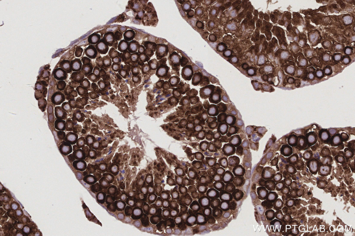 IHC staining of mouse testis using 83594-4-RR
